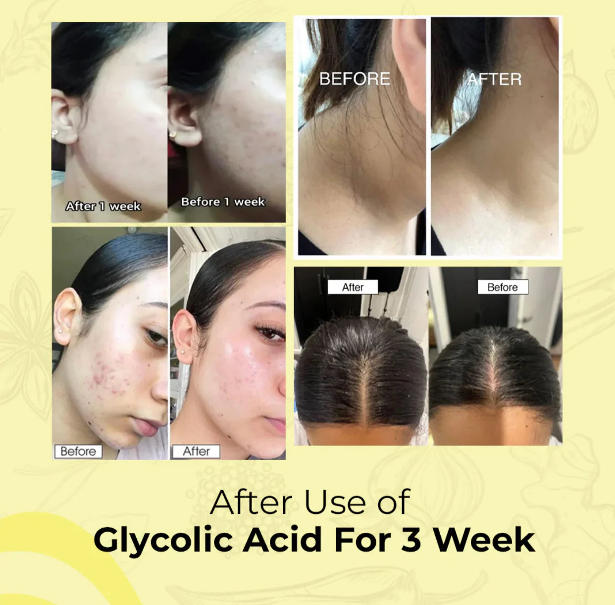 GLYCOLIC ACID 7% TONING SOLUTION