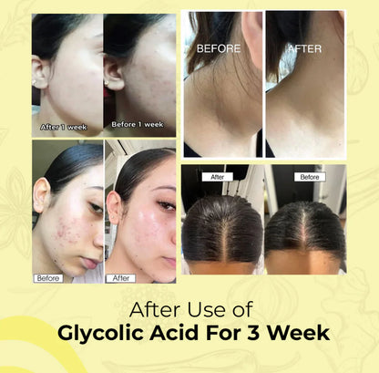 GLYCOLIC ACID 7% TONING SOLUTION
